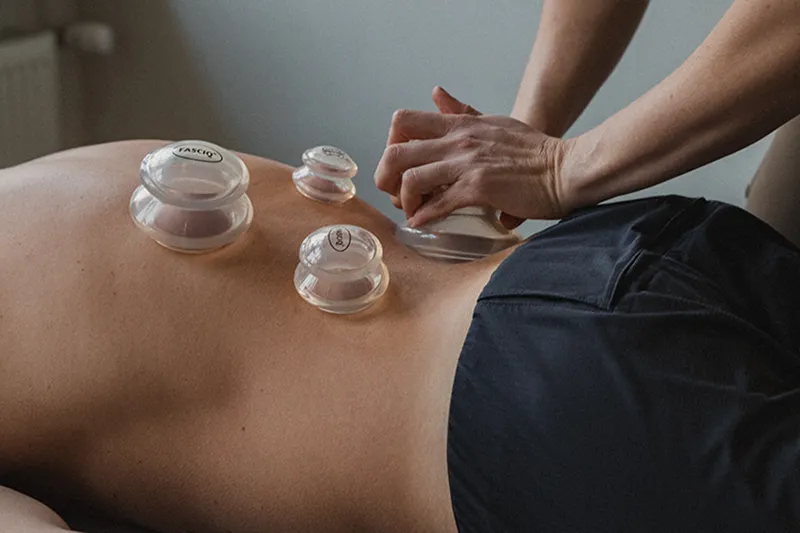 Cupping